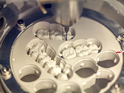 Granger Dentistry | Dental Bridges, Implant Restorations and Dental Cleanings