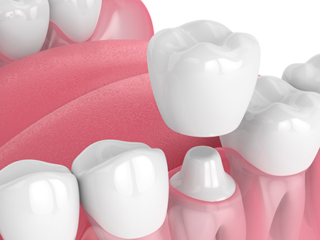 Kids Dental Avenue